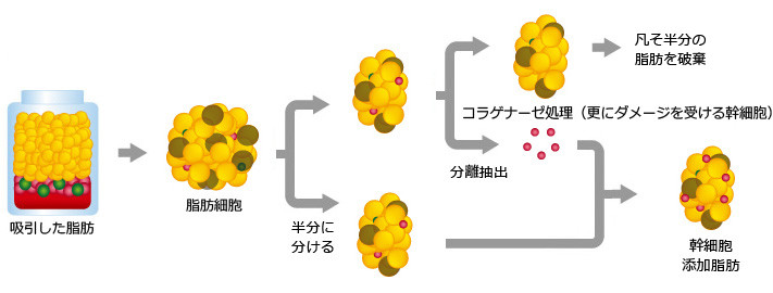 CAL組織増大方式