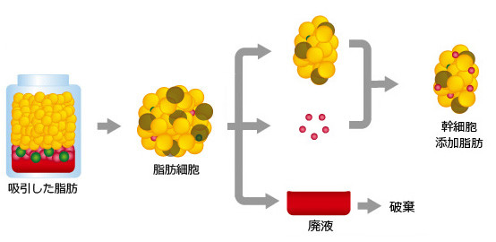 セリューション方式