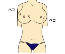 バスト表面にヘコみがでてきた