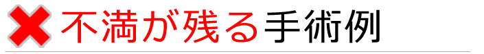 不満が残る手術例