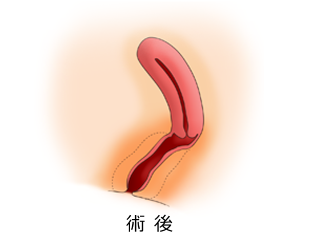術式