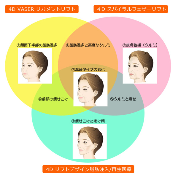 Kunoクリニック 4Dリフトとは