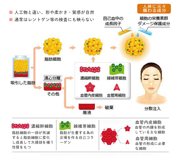 脂肪幹細胞再生医療